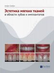 Эстетика мягких тканей в области зубов и имплантатов