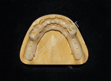 Фотогалерея Bio Dentaplast®