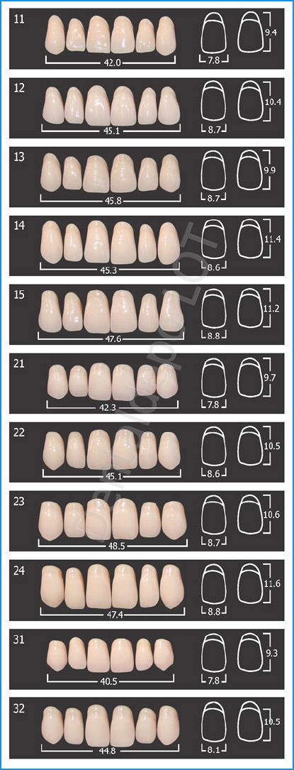 Upper Anteriors