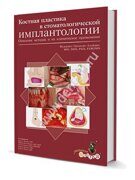 Костная пластика в стоматологической имплантологии. Фредерико Эрнандус Альфаро