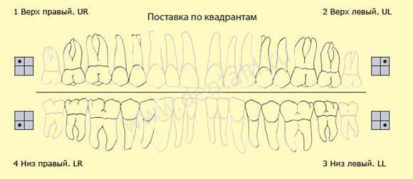 Постановка